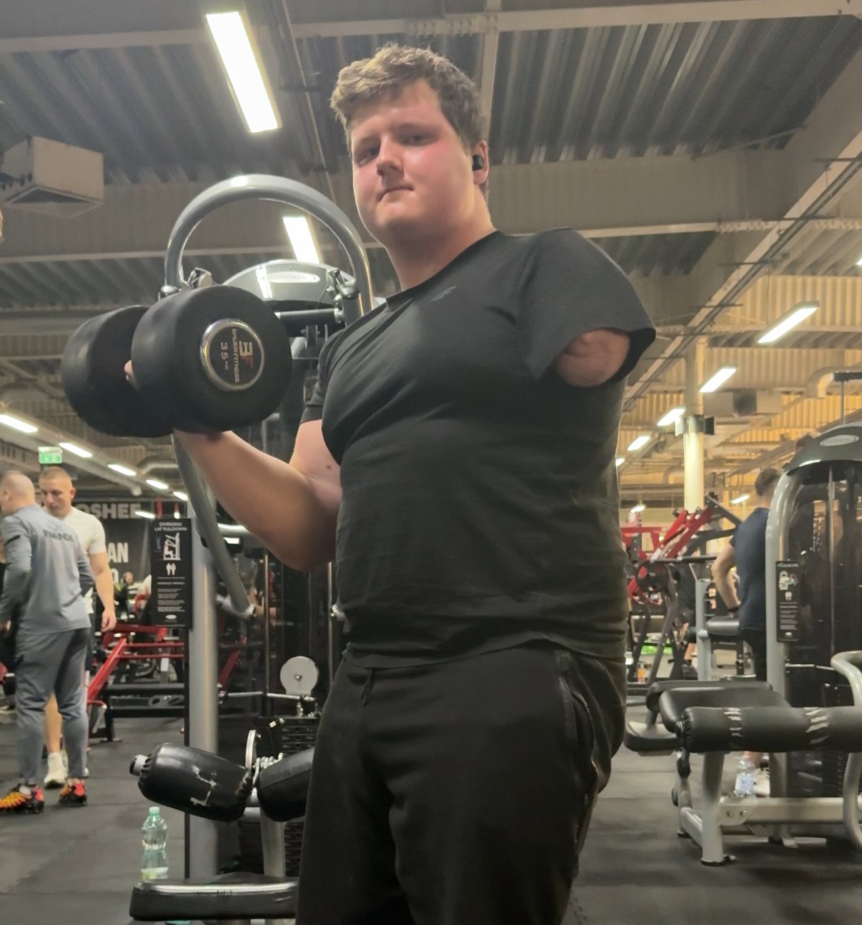 Osseointegracja To Nadzieja Na Aktywność